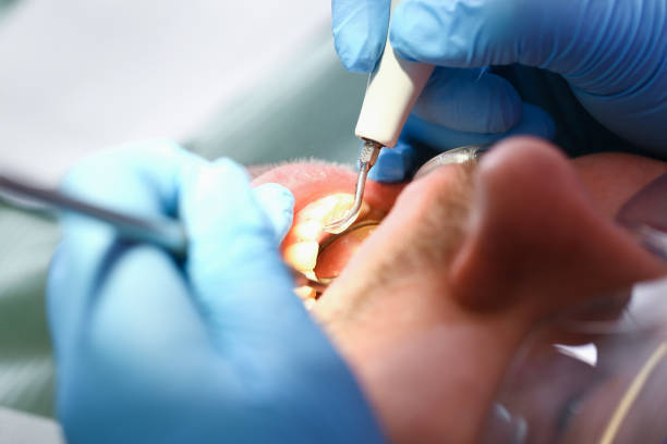 Best Knocked-Out Tooth Emergency  in San Gabriel, CA